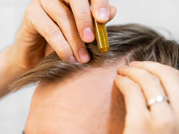 Un sérum à base de plante relance la croissance des cheveux en 56 jours : ce que dit vraiment l&rsquo;étude