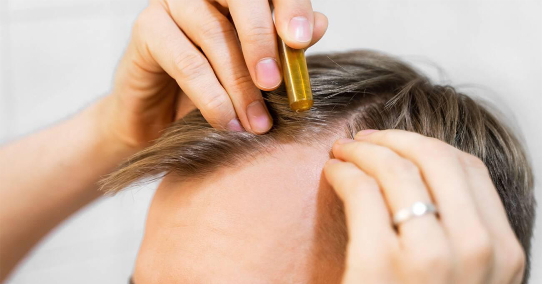 Un sérum à base de plante relance la croissance des cheveux en 56 jours : ce que dit vraiment l&rsquo;étude