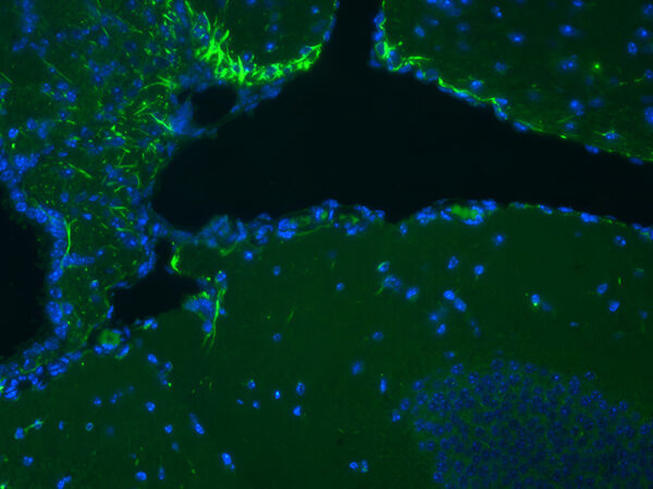 Comprimer le tibia aiderait le cerveau à se réparer après une lésion