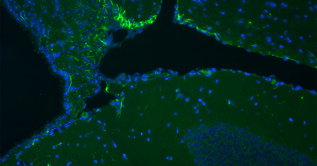 Comprimer le tibia aiderait le cerveau à se réparer après une lésion